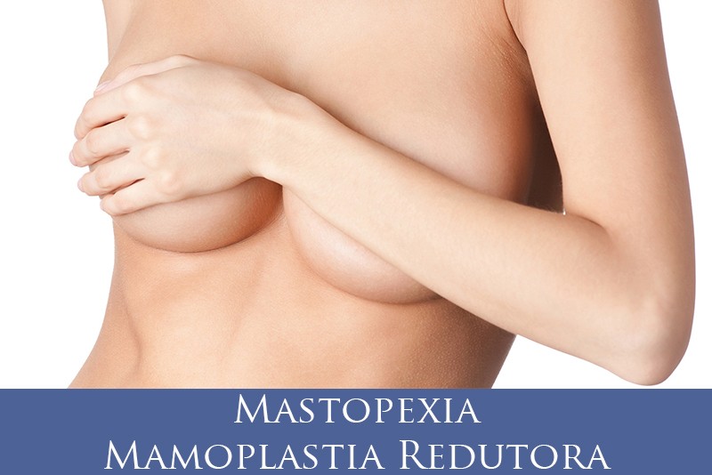 Mamoplastia Redutora/Mastopexia
